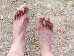 Feet
